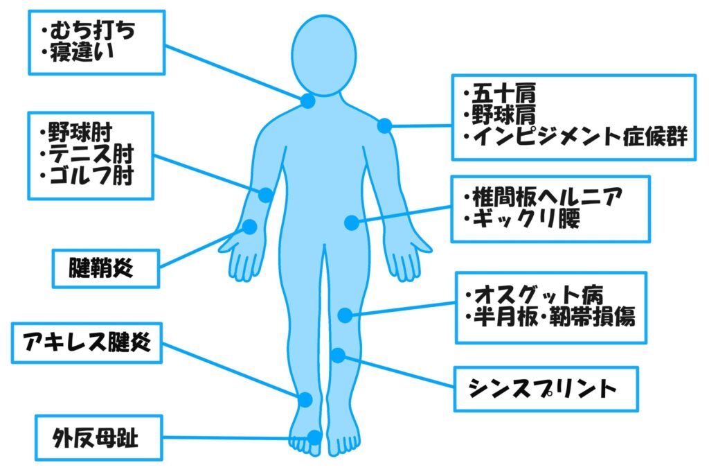 スポーツ障害・外傷の代表的な症状